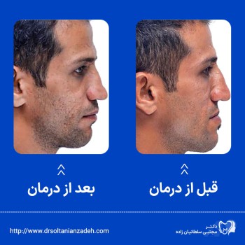 جراحی اورتوگناتیک