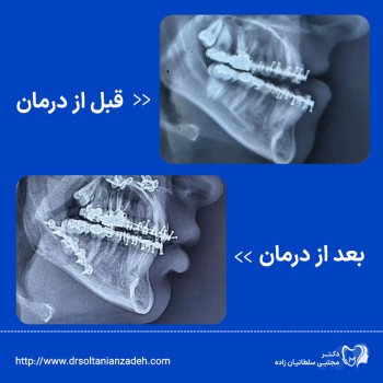 جراحی اورتوگناتیک