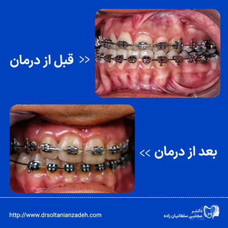 جراحی اورتوگناتیک